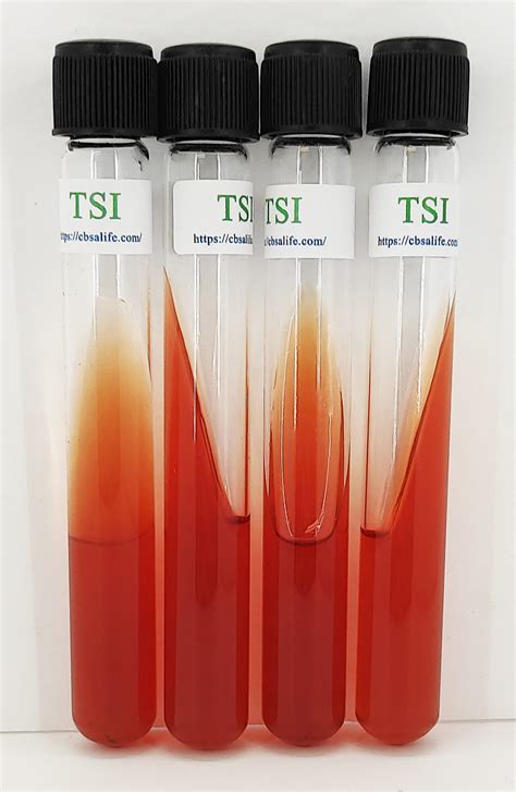 TRIPLE SUGAR IRON (TSI) T .